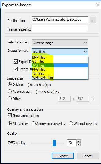 MicroDicom viewer(Dicom格式看图软件)