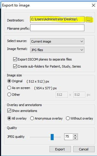 MicroDicom viewer(Dicom格式看图软件)